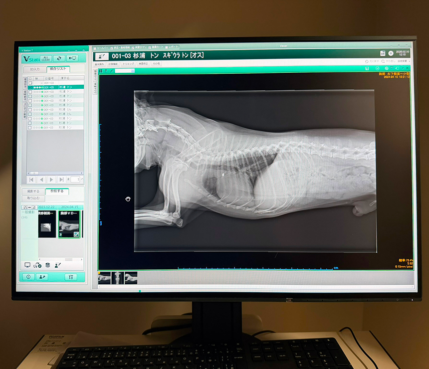 レントゲン検査装置
